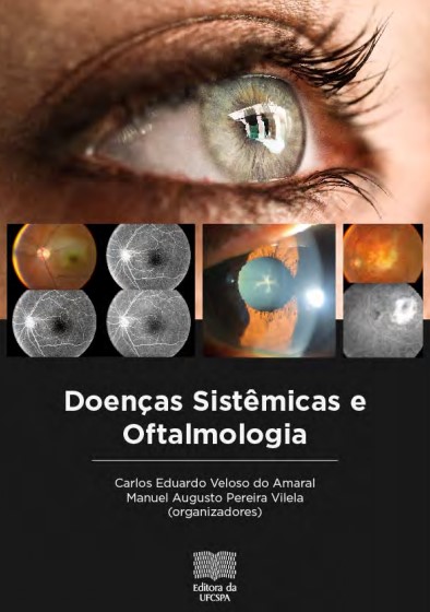 Central Serous Chorioretinopathy Classification